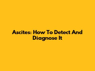 Ascites: How To Detect And Diagnose It